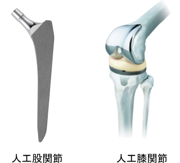 帝人ナカシマメディカル社製　人工股関節、人工膝い関節　画像