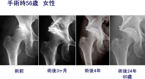 流行の過激なダイエットは方法は全て有害　画像