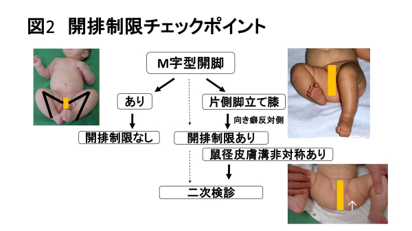 図2　開排制限チェックポイント　画像