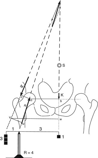 Biomechanics of the Normal and Diseased Hip. Theoretical Foundation, Technique and Results of Treatment Atlas. Springer-Verlag, 1976より改変