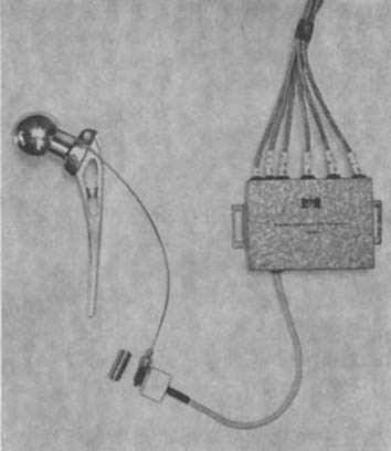 Rydell NW. Forces acting on the femoral head-prosthesis. A study on strain gauge supplied prostheses in living persons. Acta Orthop Scand 1966; 37(Suppl 88):1-132のp48より引用.