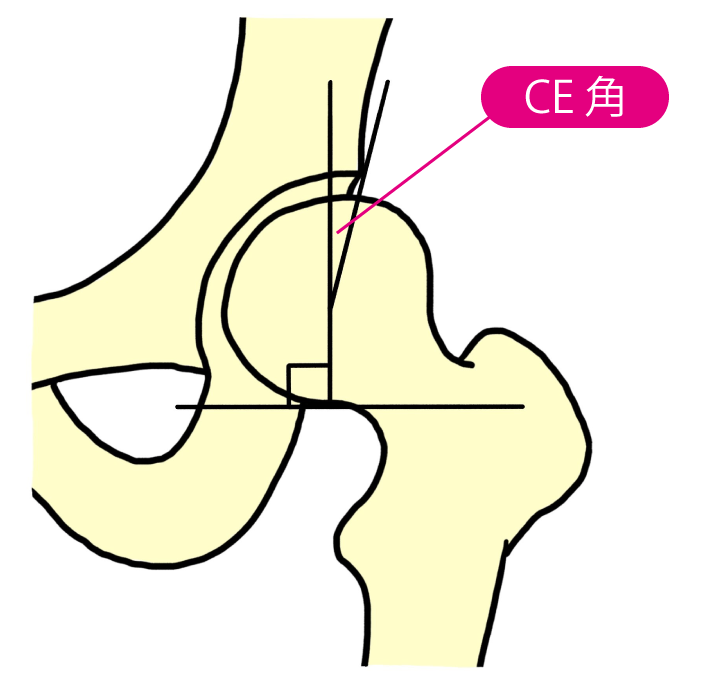 CE角　吹き出し線と名詞