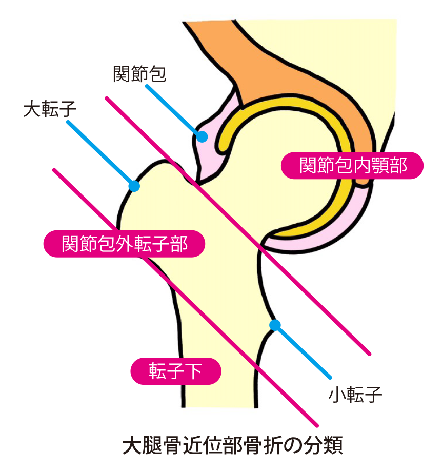 公益財団法人股関節研究振興財団 新 股関節がよくわかる本web版